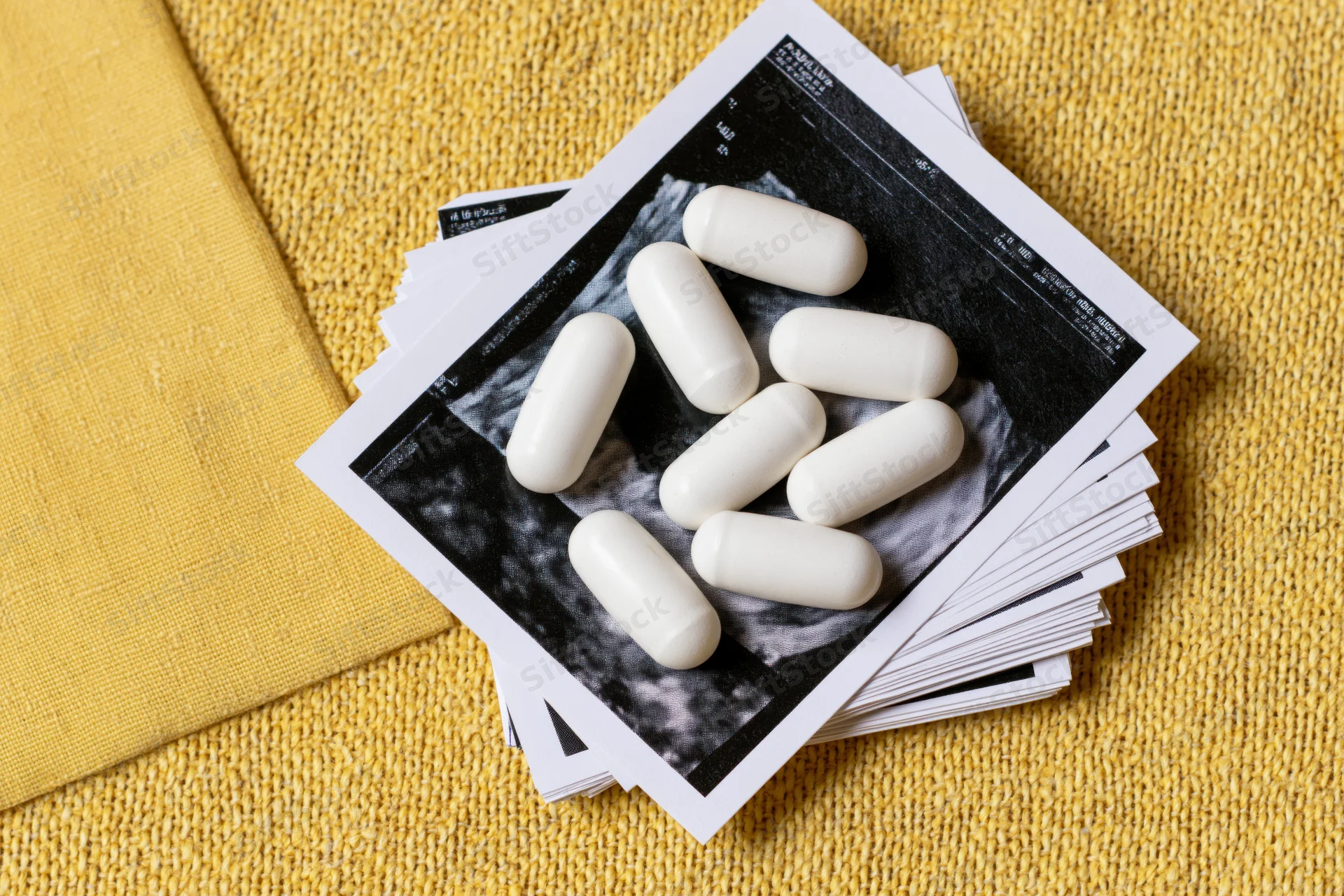 White supplement capsules scattered on top of ultrasound prints on yellow fabric