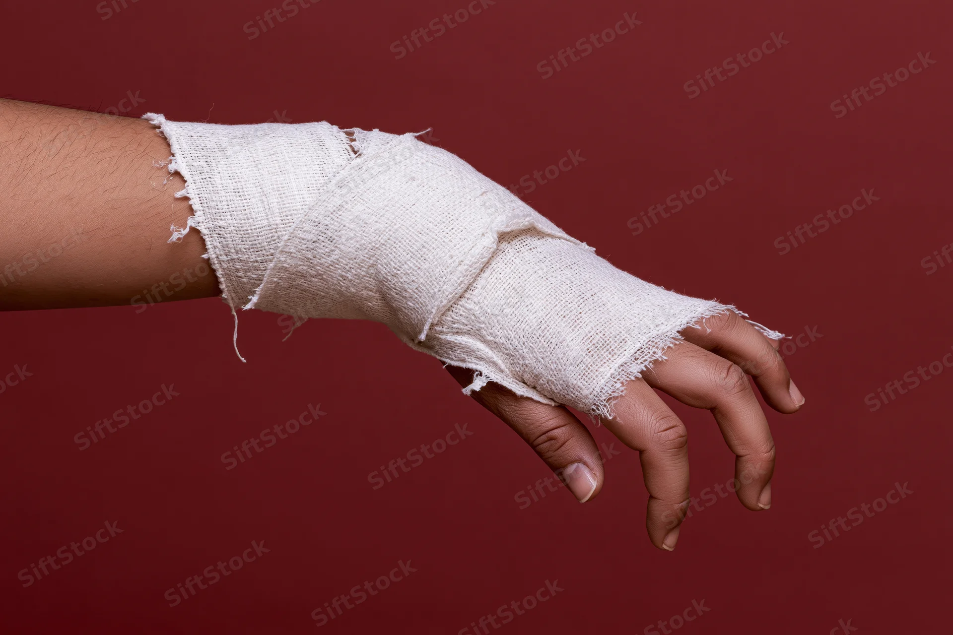 Hand wrapped in frayed white gauze bandage against red background